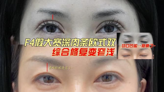 眼部修复