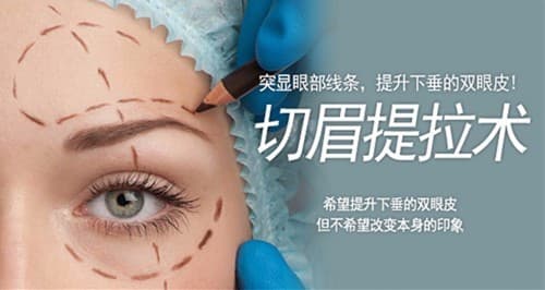 切眉术