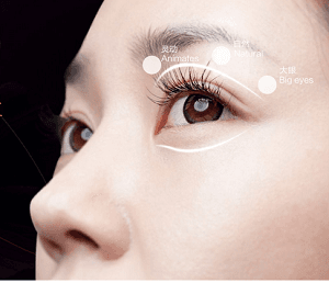上眼睑去脂