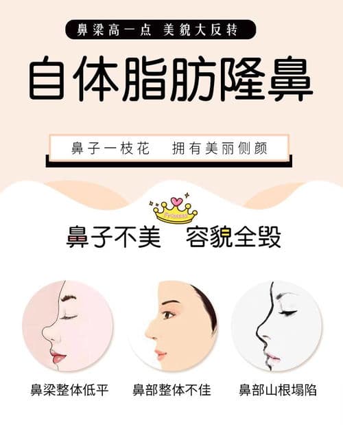 自体脂肪丰鼻基底