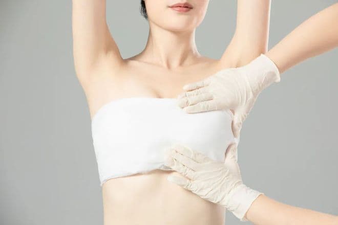 乳晕缩小