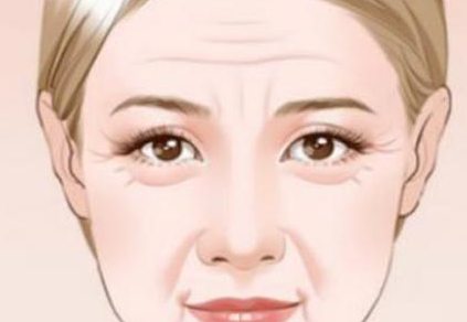 玻尿酸去抬头纹